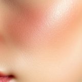 Zabieg na zamknięcie porów – jak poprawić wygląd skóry?