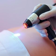 Laser punktowy w rehabilitacji – jak działa i jakie ma efekty?