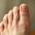 Choroby paznokci u nóg – objawy, diagnostyka i pielęgnacja