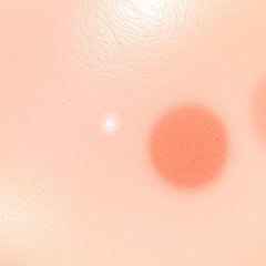 Retinol na przebarwienia: co robić, gdy pojawi się podrażnienie