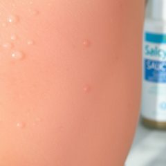 Kwas salicylowy na zaskórniki: jak dobrać produkt i nie przepłacić