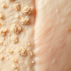 Skóra sucha i odwodniona różnice: kiedy łączyć, a kiedy robić przerwy w aktywach